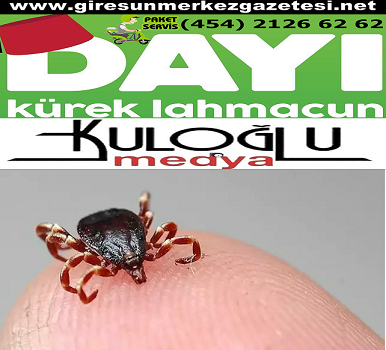 Giresun'da kene tedavisi 